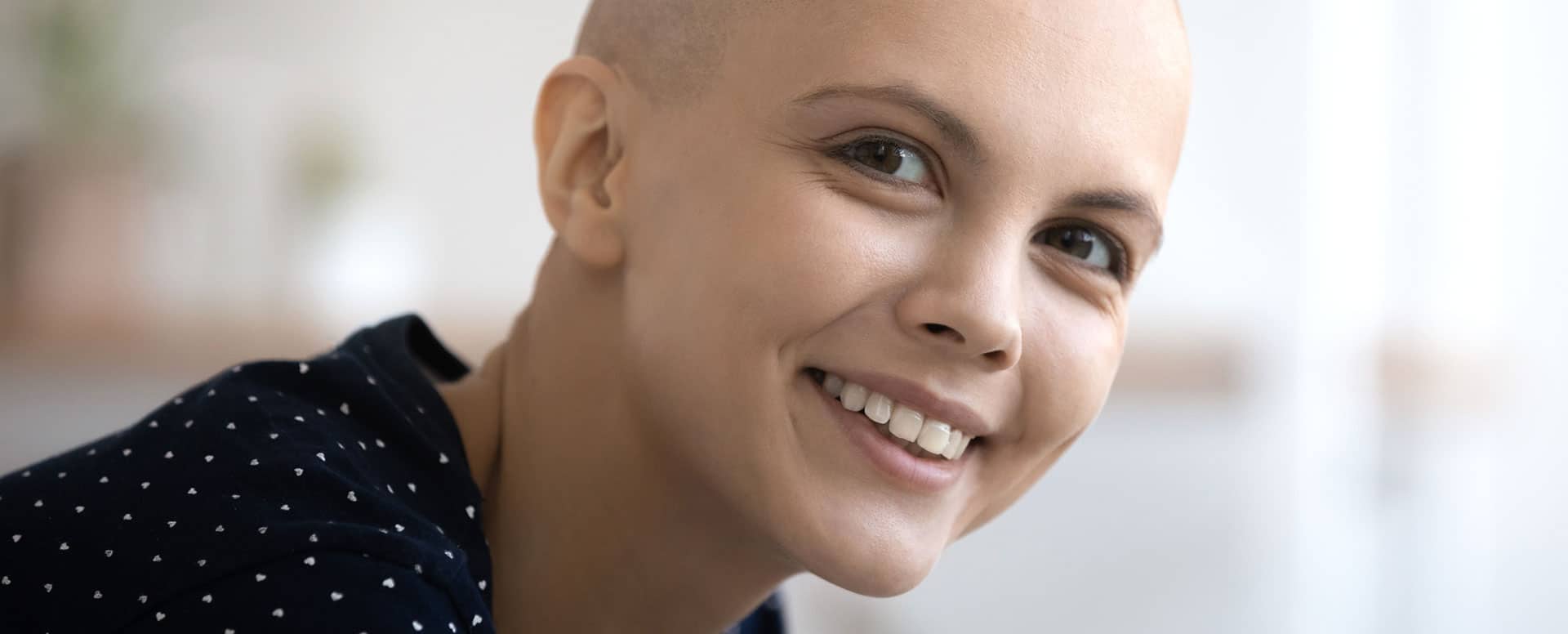 Femme ayant perdu ses cheveux dû au cancer