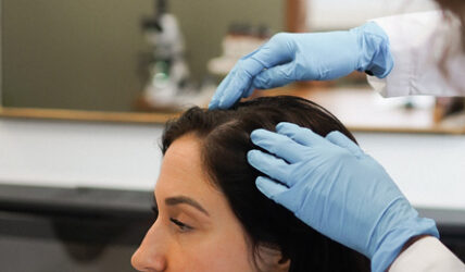 Femme qui consulte pour le PRP cheveux
