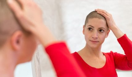 Jeune femme qui a perdu ses cheveux à la suite de traitements de chimiothérapie