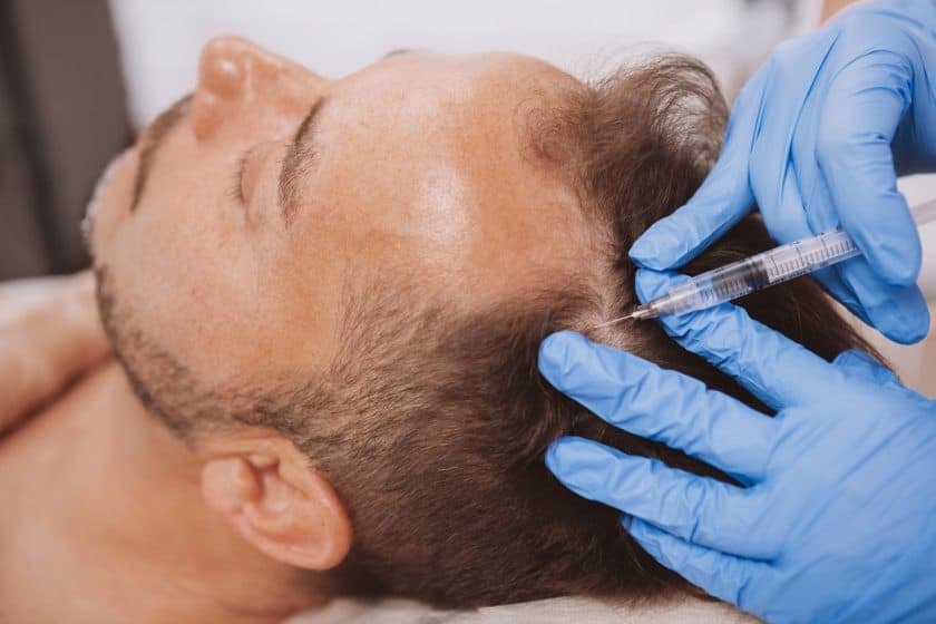 Homme recevant une injection de plasma riche en plaquettes pour les cheveux