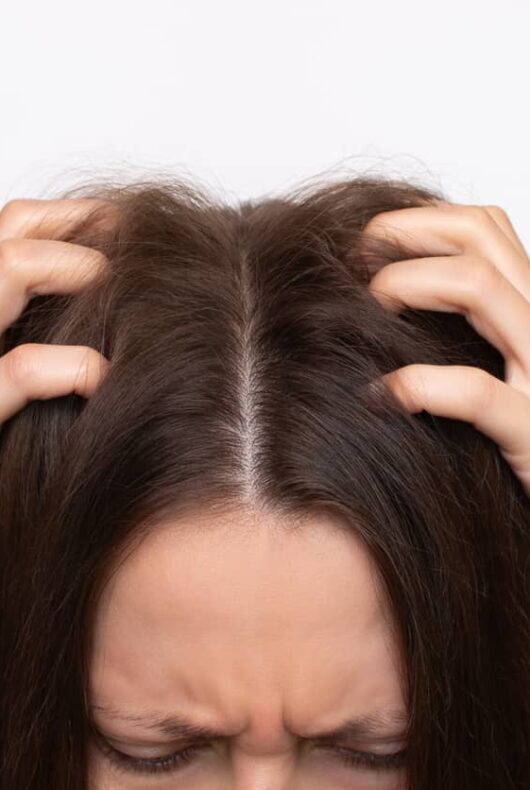 Une femme ayant le cuir chevelu qui pique se gratte la tête.